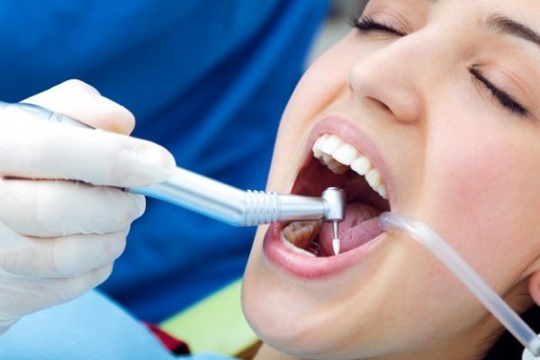 Implantes dentales Murcia